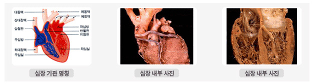 심장 기관 명칭, 심장 내부 사진